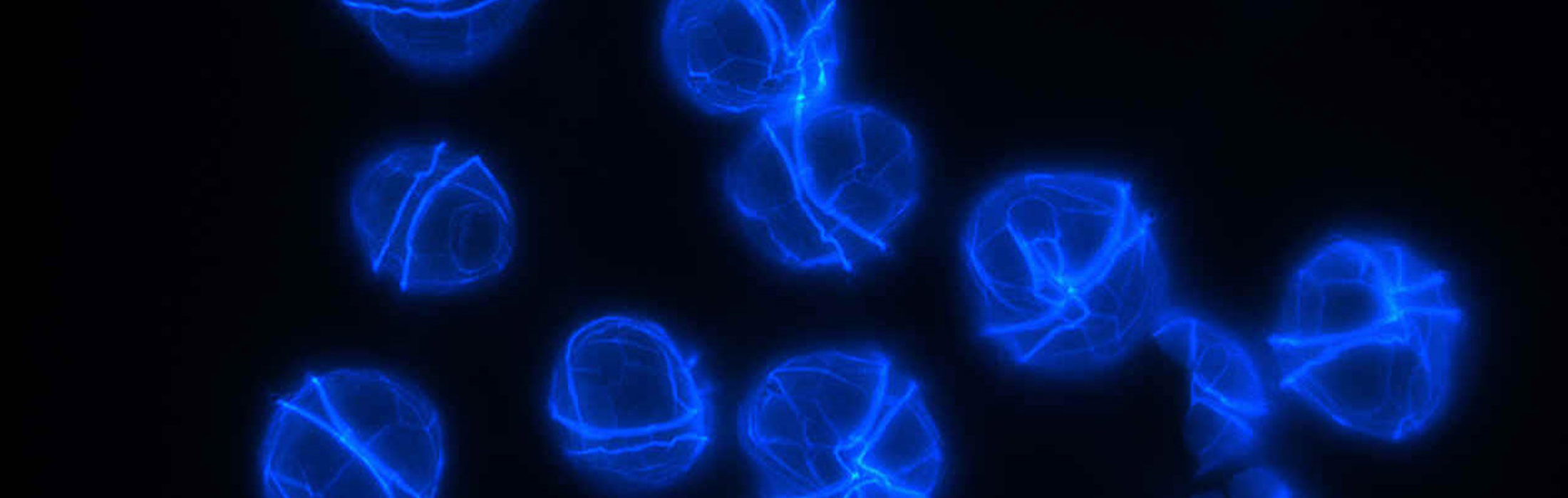 Calcafluor stained Alexandrium catenella, viewed under fluorescence. Photo by G. Usup 