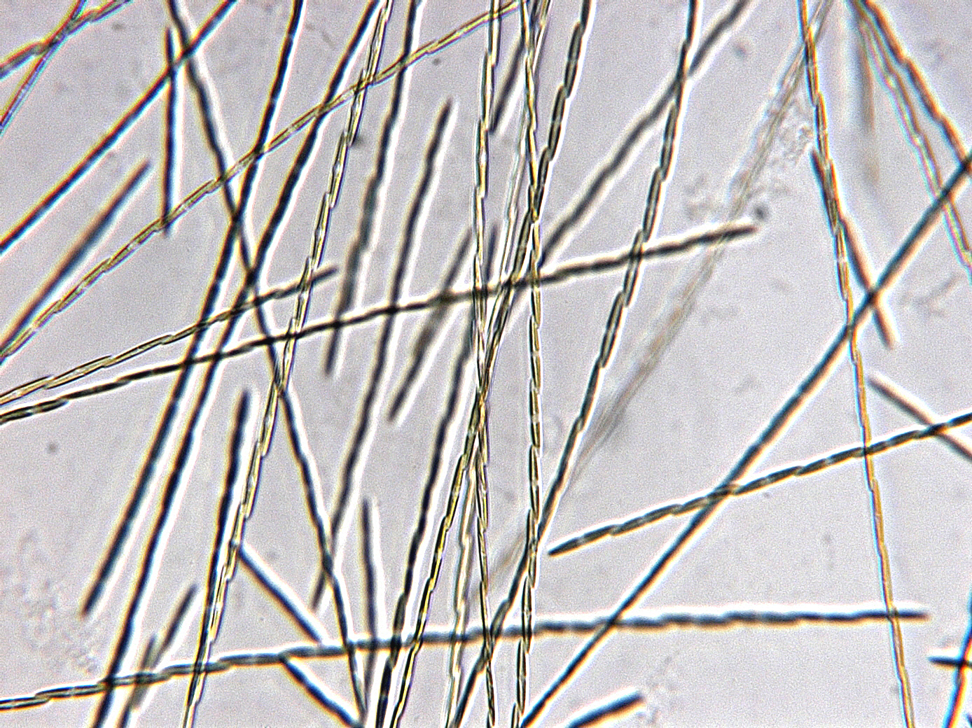 Chains of <em>Pseudo-nitzschia</em> sp. isolated from the Gulf of Maine. (L. Fernandes)