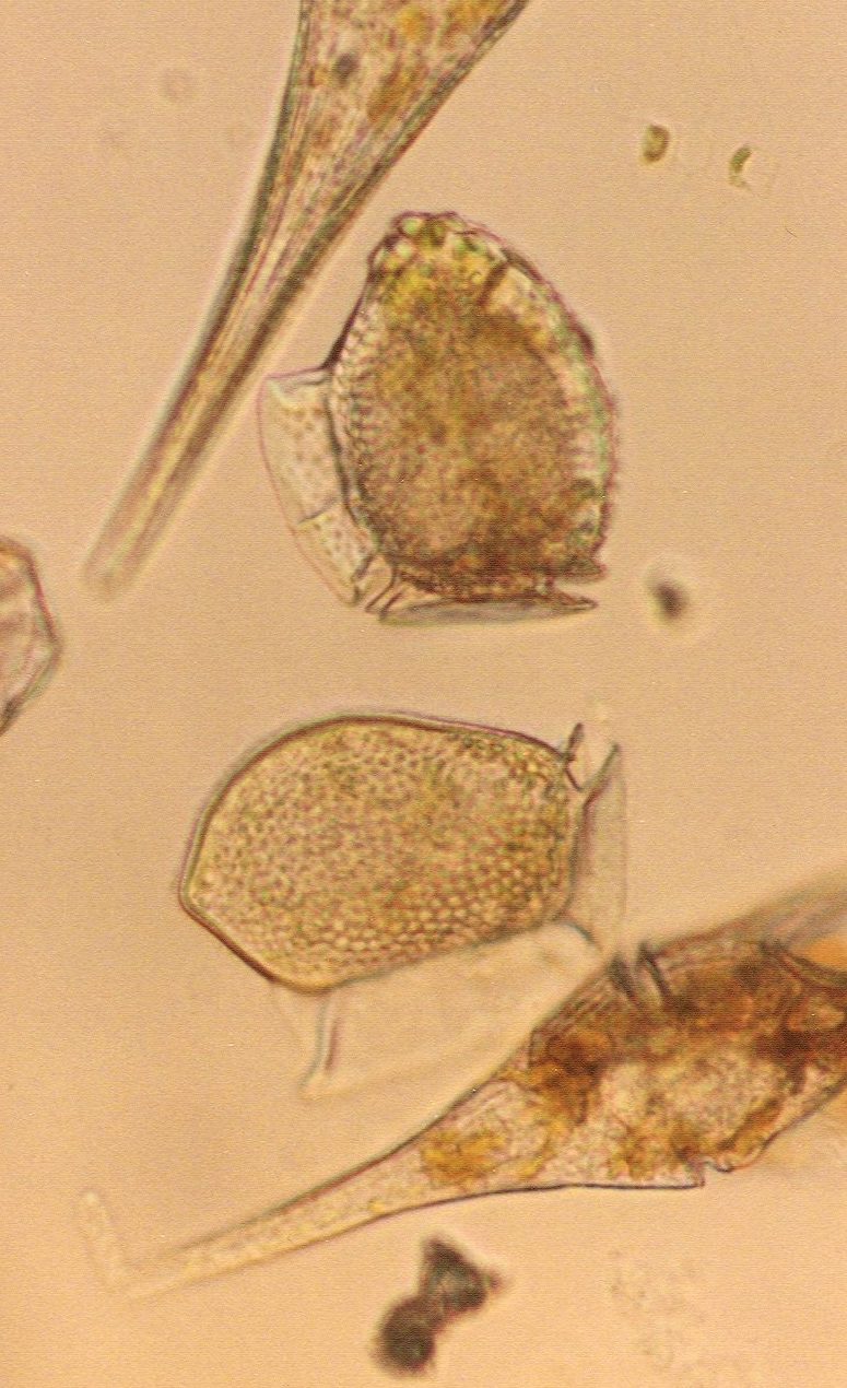 <i>Dinophysis</i> and other dinoflagellates (D. Anderson)