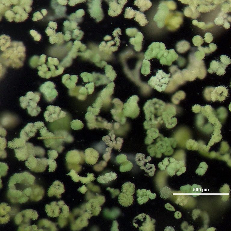 https://commons.wikimedia.org/wiki/File:Algae,_Microcystis_(8741972050)_contrast%C3%A9.jpg