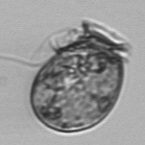 The Imaging FlowCytobot captured this image of the toxic alga <i>Dinophysis acuminata</i> during the bloom in March 2008.  (H. Sosik and R. Olson, WHOI, and L. Campbell, Texas A&amp;M)